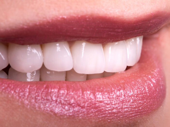 Womans-smile-showing-teeth-after-cosmetic-teeth-bonding-procedure